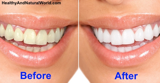 how to get my teeth white naturally